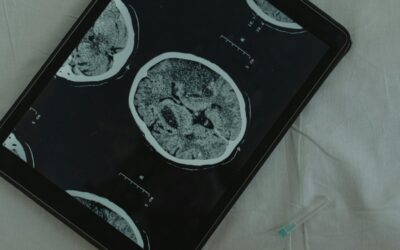 Le métamère cervical : les clés pour la kinésithérapie neurologique